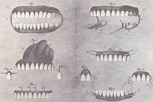 Teeth2